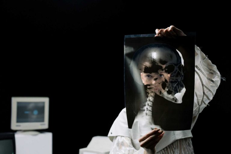 a person holding a medical xray up to their face